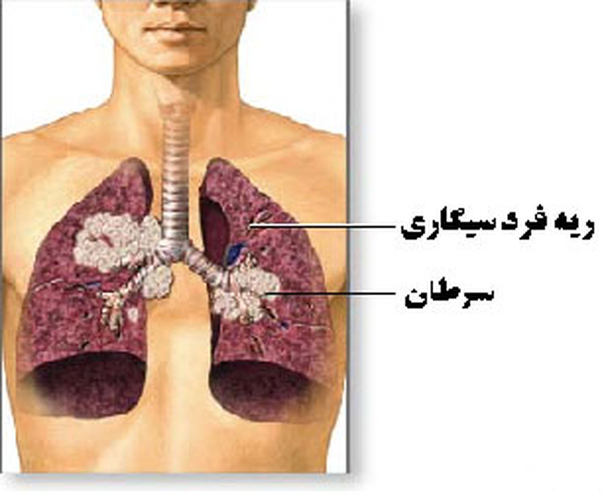 این 10 گیاه ریه های شما را شستشو می دهند 