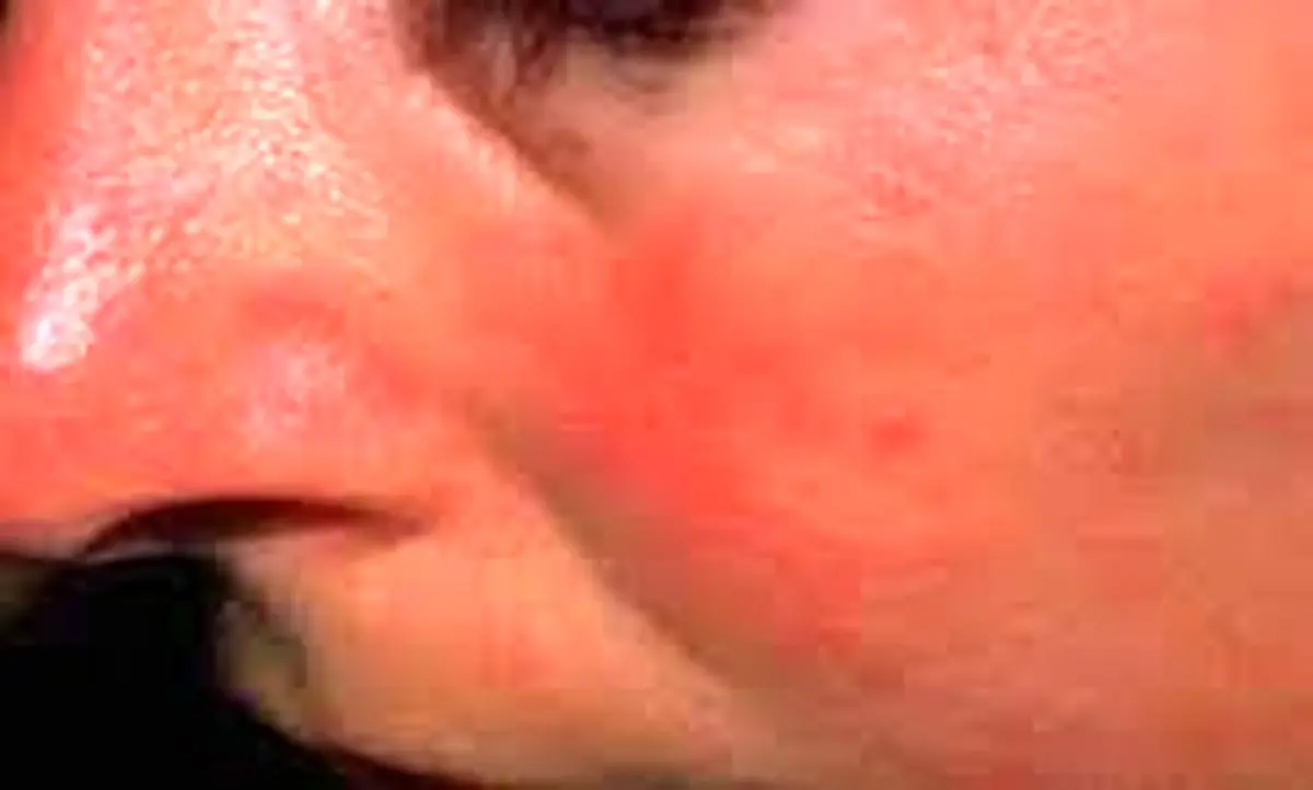 هشدار ، این بیماری تابستانه را در این فصل جدی بگیرید