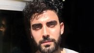 بازیگر چشم روشن سریال مانکن در قاب پنجره + عکس