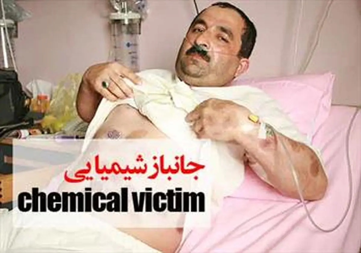 کوتاهی وزارت خارجه در دریافت غرامت جانبازان شیمیایی