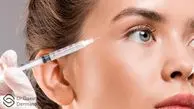 تزریق فیس فریم متد جدیدترین ترند زیبایی در ایران