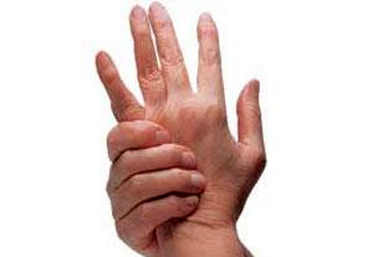 اگر آرتروز دارید این مطلب را بخوانید