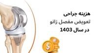 هزینه تعویض مفصل زانو در سال 1403 چقدر است؟