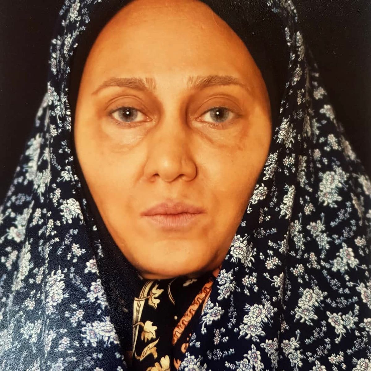 بیماری قلبی مادر حبیب در لیسانسه ها!