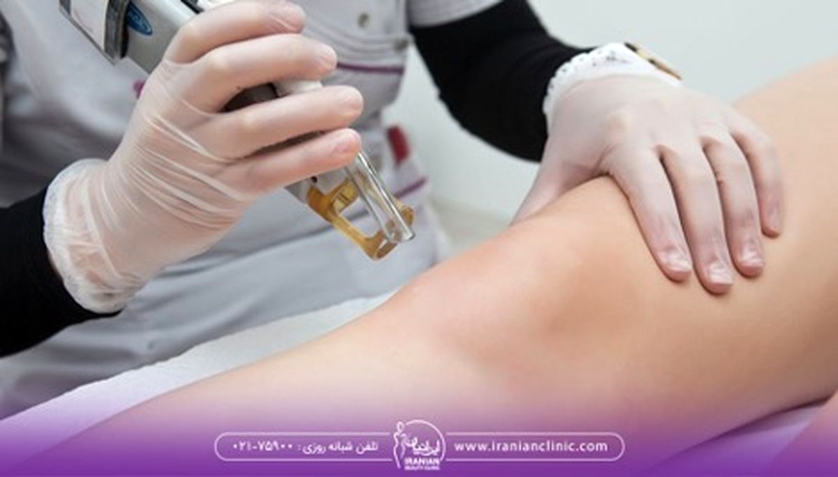 چرا از لیزر موهای زائد نتیجه نمی گیریم؟