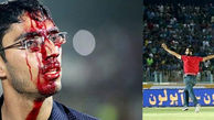  مرد محبوب پرسپولیس: صورت من هم بخیه خورد 