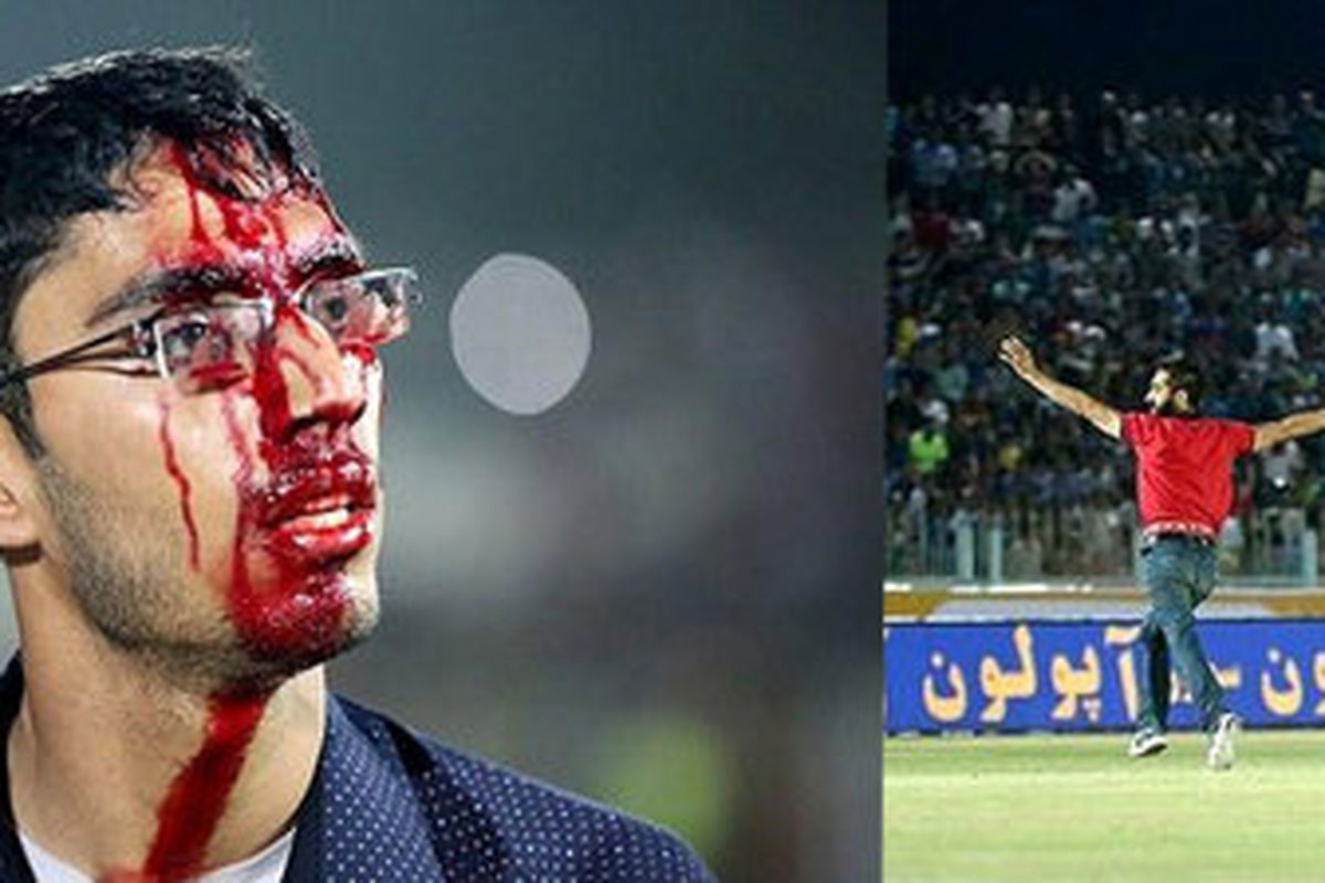  مرد محبوب پرسپولیس: صورت من هم بخیه خورد 