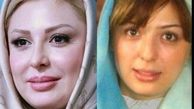 عکس قبل و بعد عمل نیوشا ضیغمی