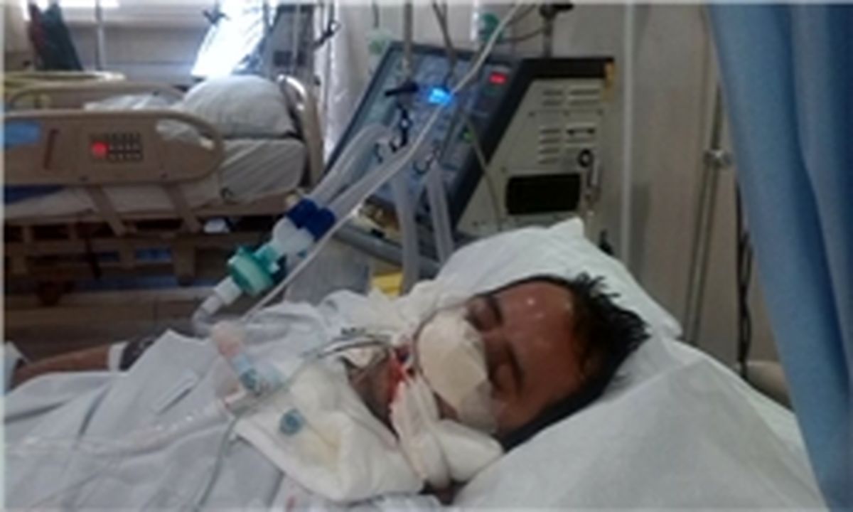 جراحی بینی جوان 33 ساله را از پای درآورد