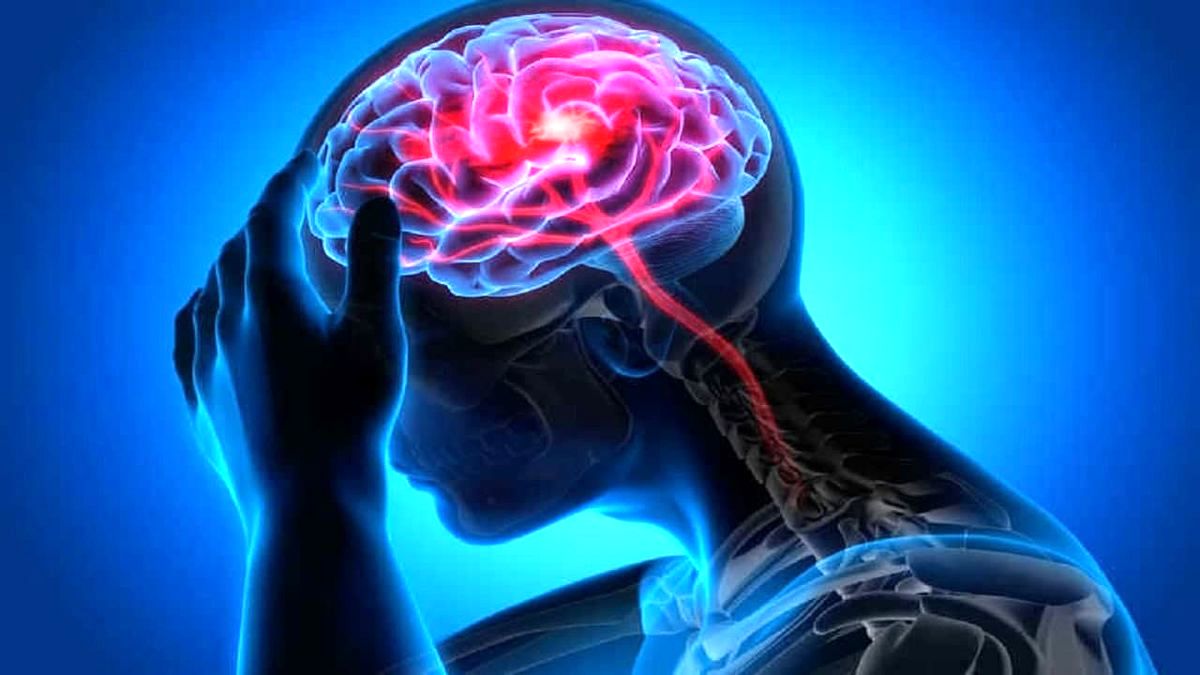 کمبود این ویتامین باعث سکته مغزی می‌ شود