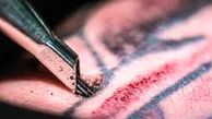 عوارض خالکوبی و تتو چیست؟ 