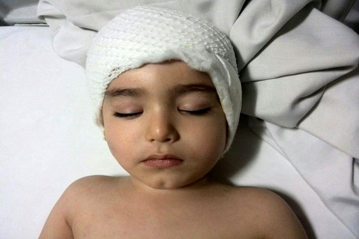 سرسره ای که کودک سه ساله را ضربه مغزی کرد