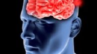 از بیماری «آنوریسم» چه می‌دانید؟