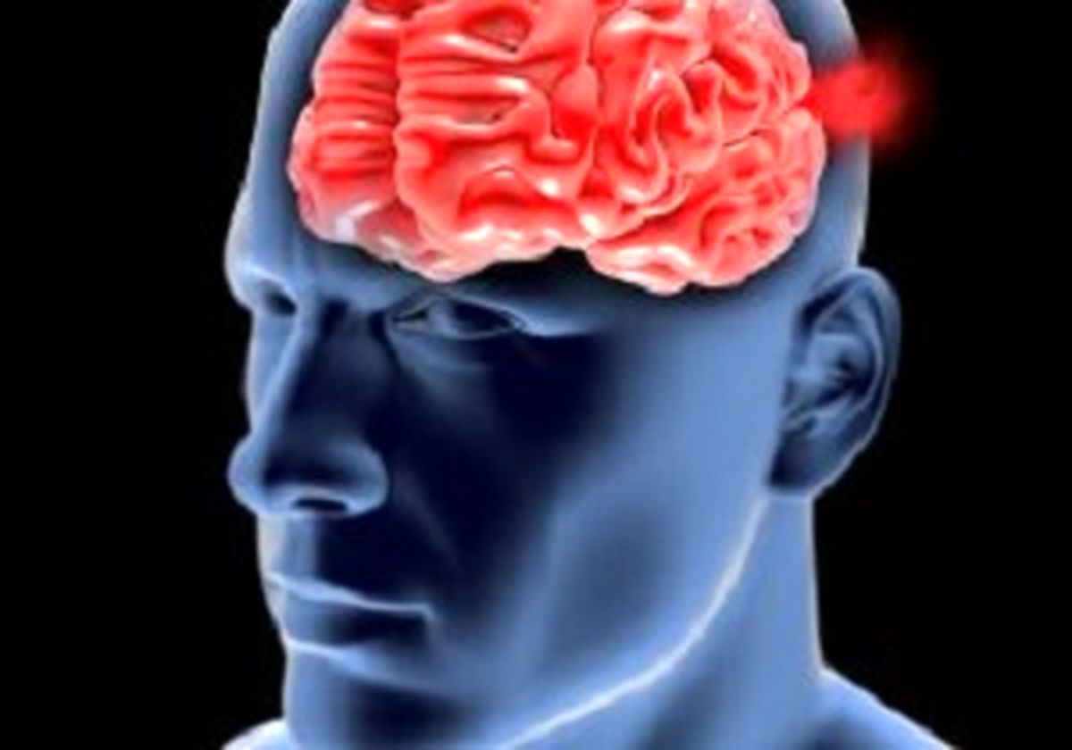 از بیماری «آنوریسم» چه می‌دانید؟