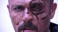 صورت ترکیده علیرضا کمالی + عکس
