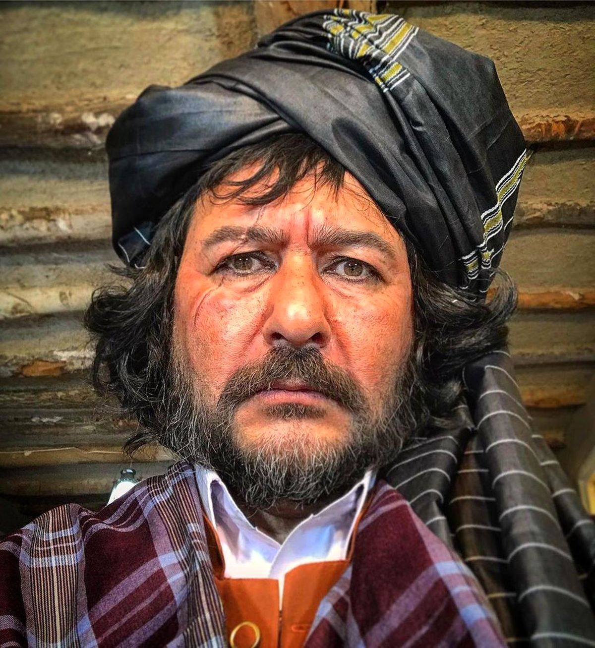 صورت زخمی امیرحسین صدیق در یک فیلم
