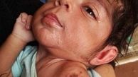 کودک آزاری به سبک گازگرفتن
