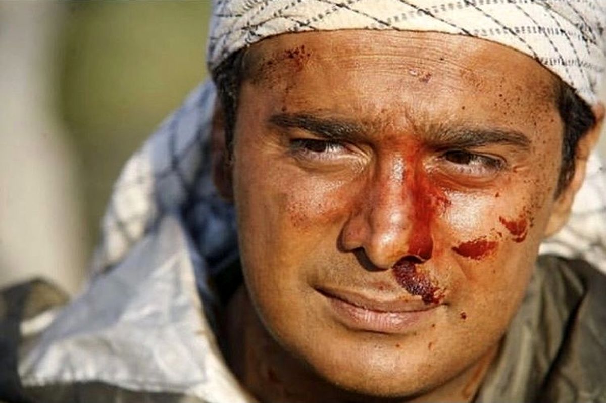صورت زخمی سپند امیرسلیمانی + عکس