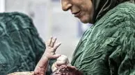 فاطمه معتمد آریا در اتاق عمل + عکس