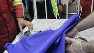 له شدن دست کودک 2 ساله در چرخ گوشت + تصاوی