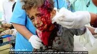  آمریکا و انگلیس مقصر فجایع یمن هستند