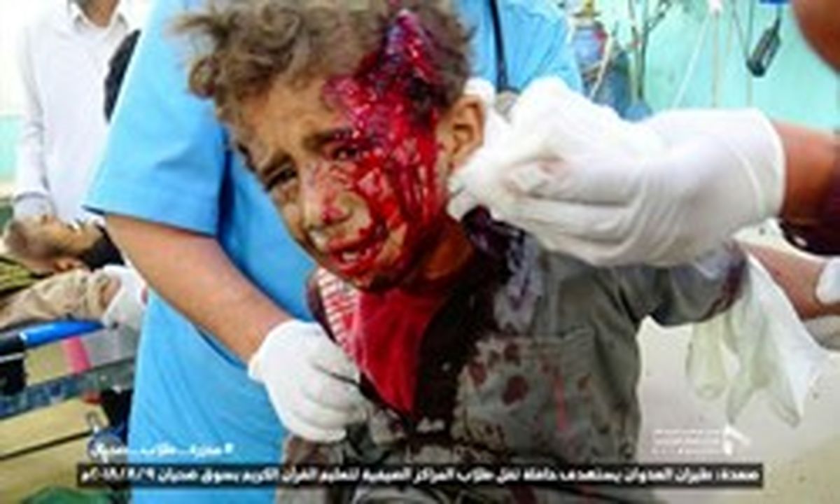  آمریکا و انگلیس مقصر فجایع یمن هستند