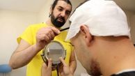 آشنایی با مراقبت‌های بعد از کاشت مو