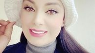ظاهر این روزهای صبا راد پس از بازگشتش به ایران + عکس