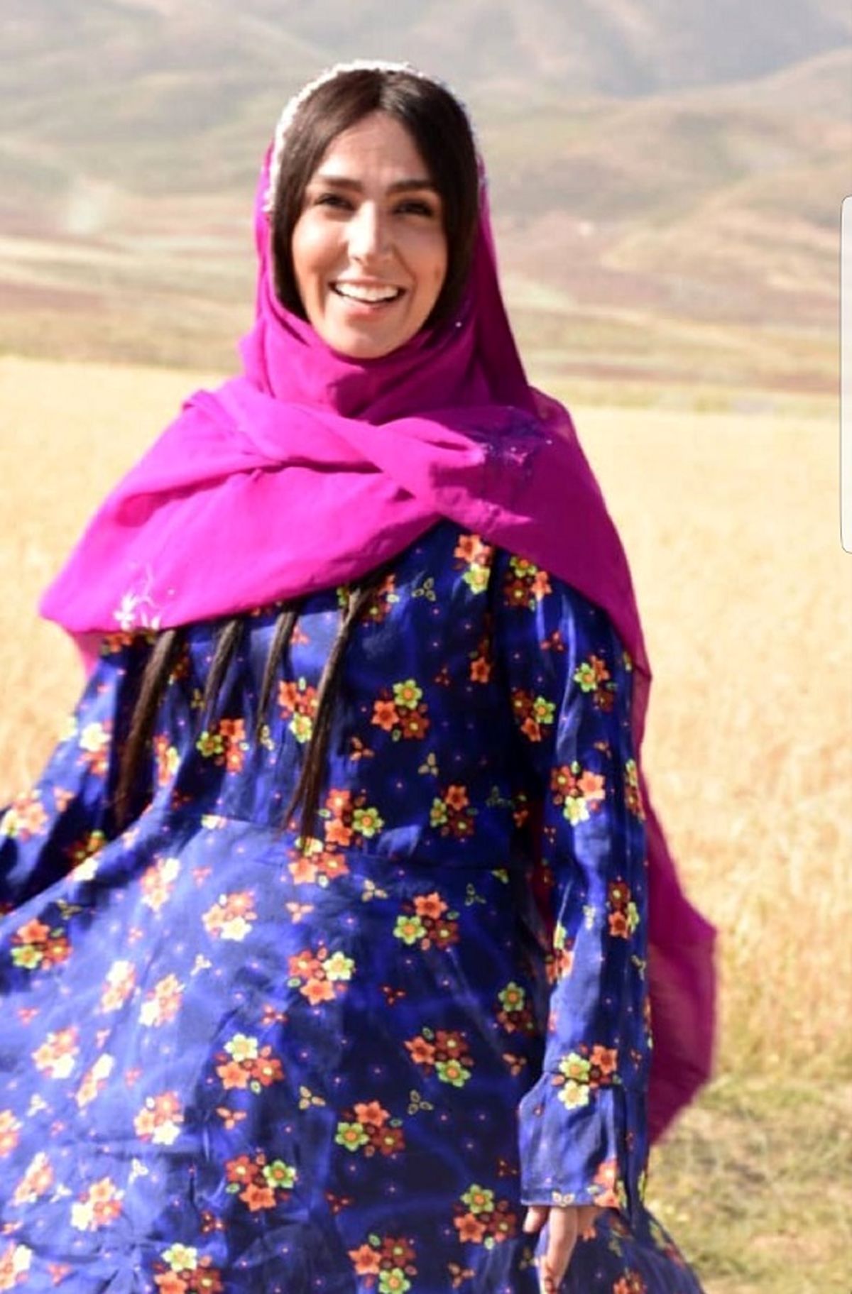 سوگل طهماسبی با مو مصنوعی+عکس
