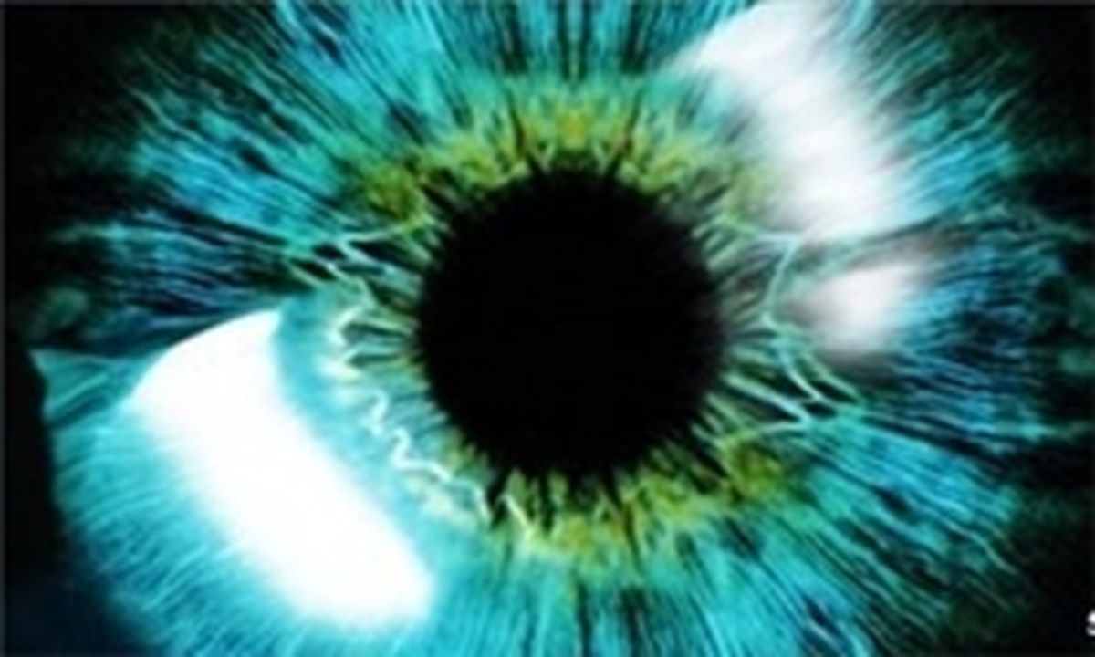 ۷۰ درصد افراد بالای ۷۵ سال آب مروارید دارند