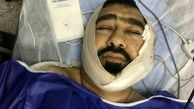 آخرین وضعیت "طلبه‌ تهرانی" که با ضربات قمه یک اوباش مجروح شد / عکس