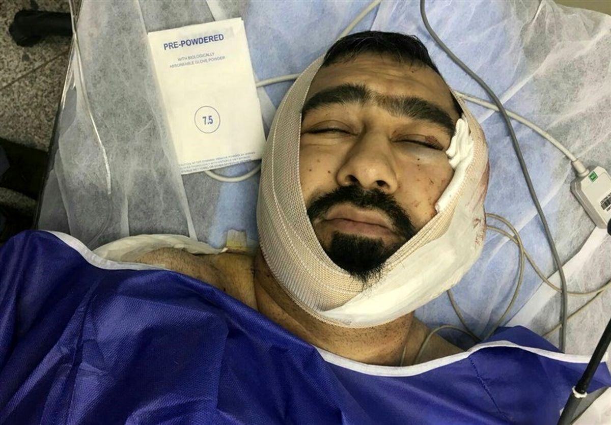 آخرین وضعیت "طلبه‌ تهرانی" که با ضربات قمه یک اوباش مجروح شد / عکس