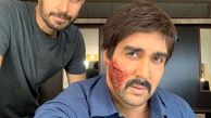 صورت داغون شده پوریا پورسرخ + عکس