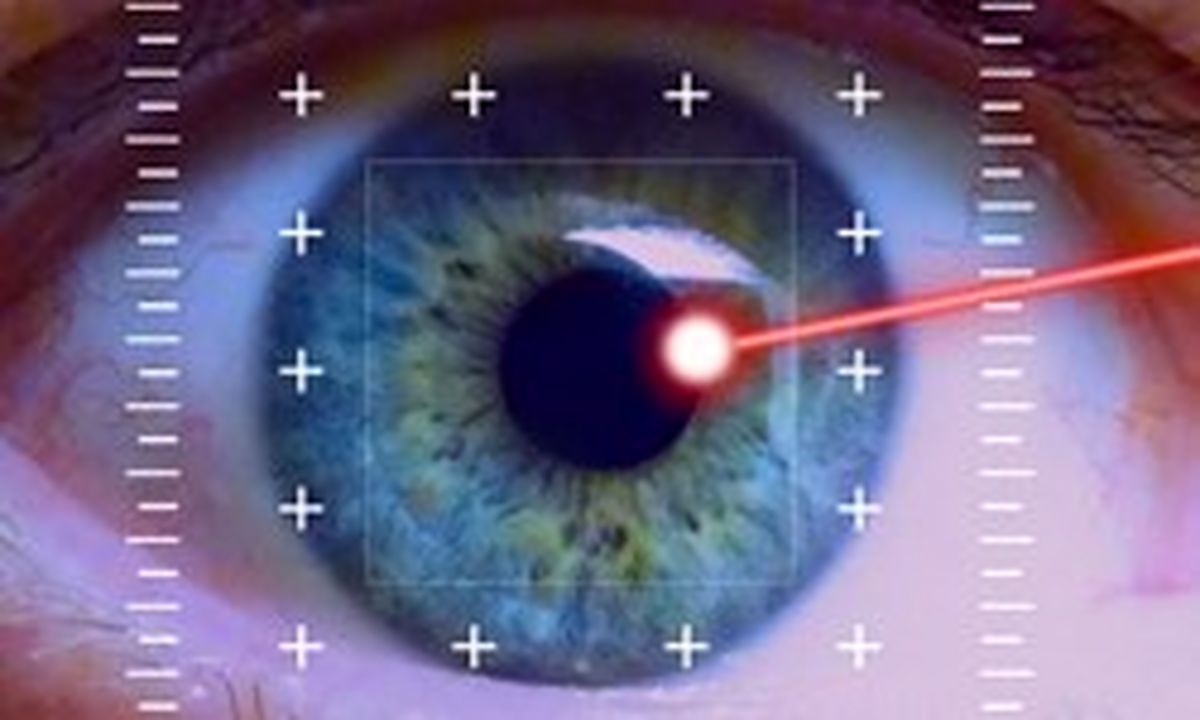 ابتلای نیمی از جامعه به نزدیک بینی طی 30 سال آینده
