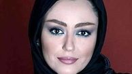 تغییر چهره «شقایق فراهانی» /عکس