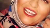 رابعه اسکویی جوانتر از قبل+عکس