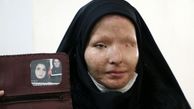 قربانی اسیدپاشی: حاضر بودم با اسلحه به سرم شلیک می‌کردند