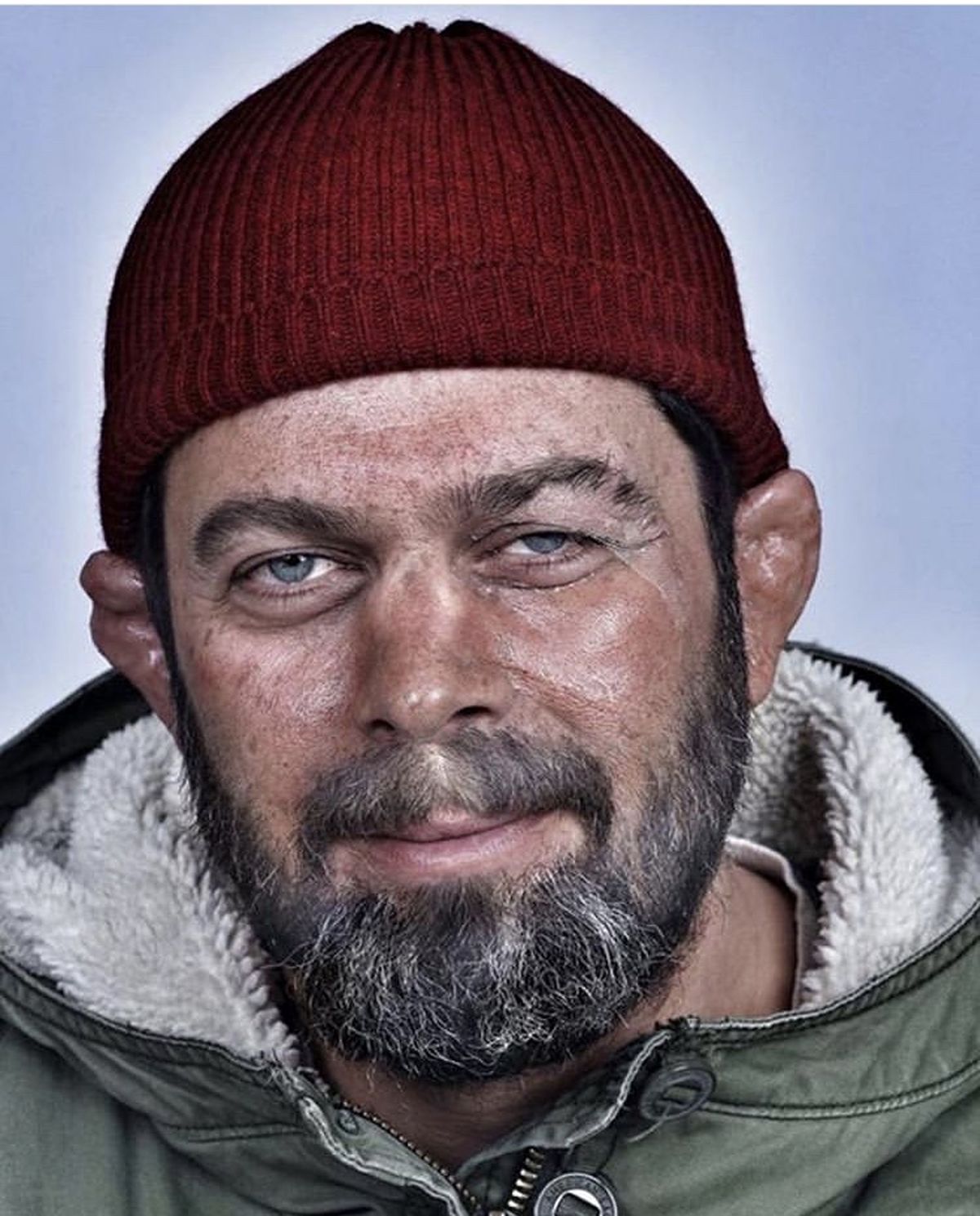 گوش شکسته پژمان بازغی + عکس