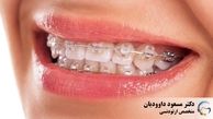 در دوران کرونا چطور به دانپزشکی مراجعه کنیم