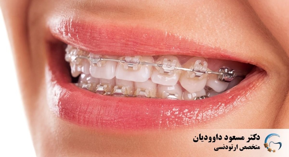 در دوران کرونا چطور به دانپزشکی مراجعه کنیم