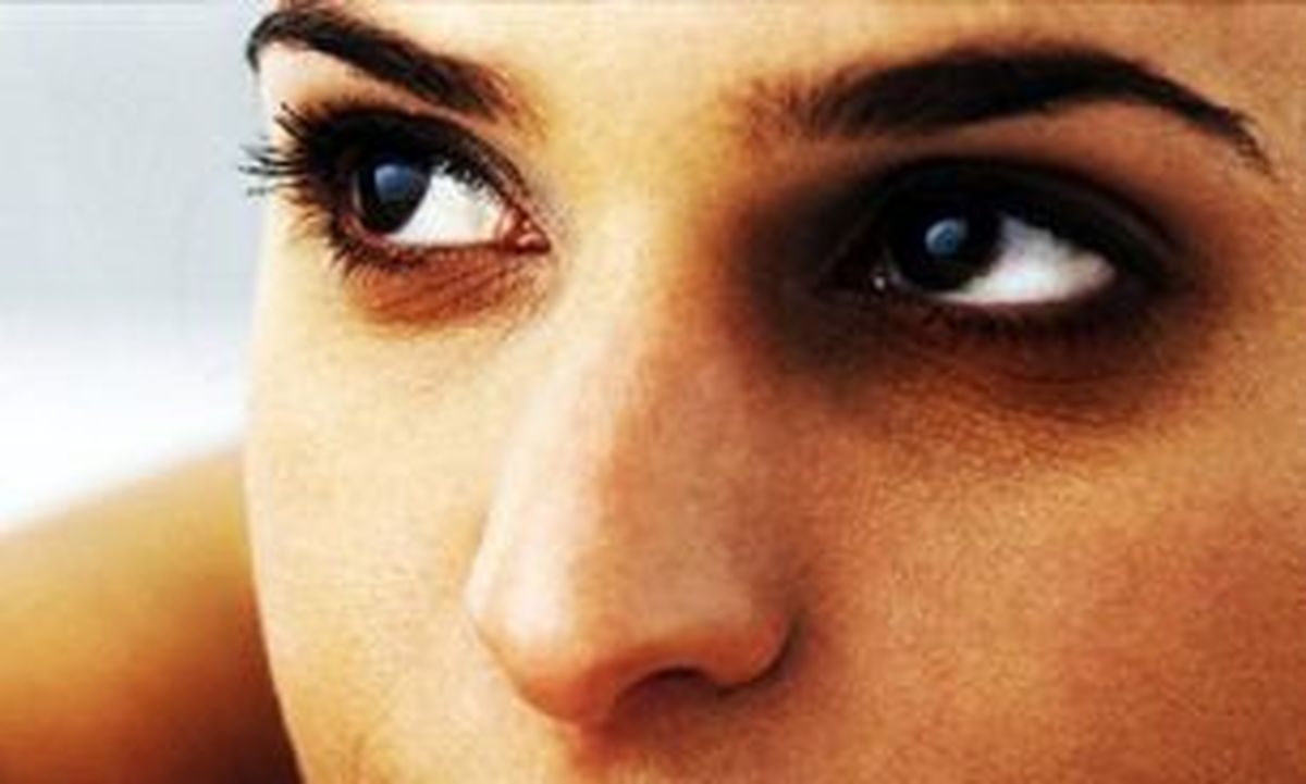 راه‌های از یبن بردن حلقه‌های سیاه زیر چشم 