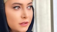 تغییر زیاد فریبا نادری با عمل زیبایی