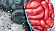 آلزایمر ۳ نوع دارد