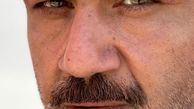 صورت لاغر شده مهران غفوریان از نمای نزدیک + عکس