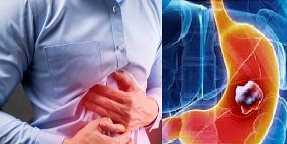 رژیم غذایی برای درمان رفلاکس