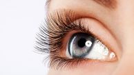 دلایل از دست دادن مژه ها چیست؟