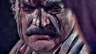 صورت زخمی مهدی سلطانی + عکس
