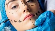جراحی زیبایی؛ انواع، خطرات، نکاتی که باید در نظر بگیرید