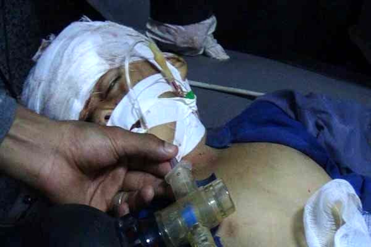 سازمان ملل: عربستان کودکان یمنی را می کُشد