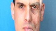 رژیم لاغری سخت، پوست را شل می‌کند